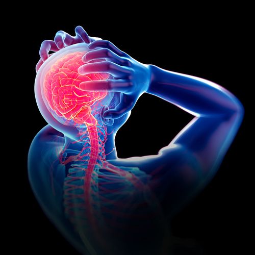 headache2